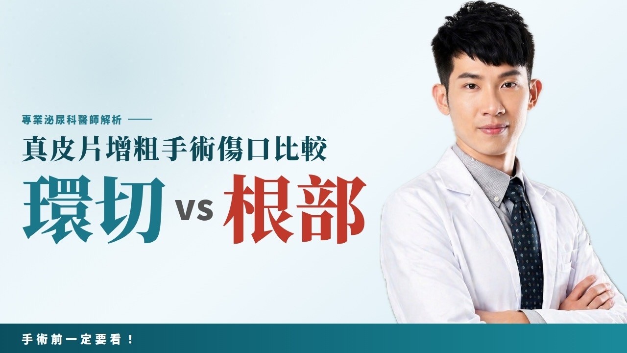 GG真皮片增粗手術全解析：兩種增粗方式優缺點大公開，術後不再焦慮